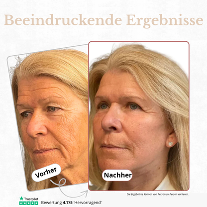 Celyana Calcium-Aufpolsternder Balsam