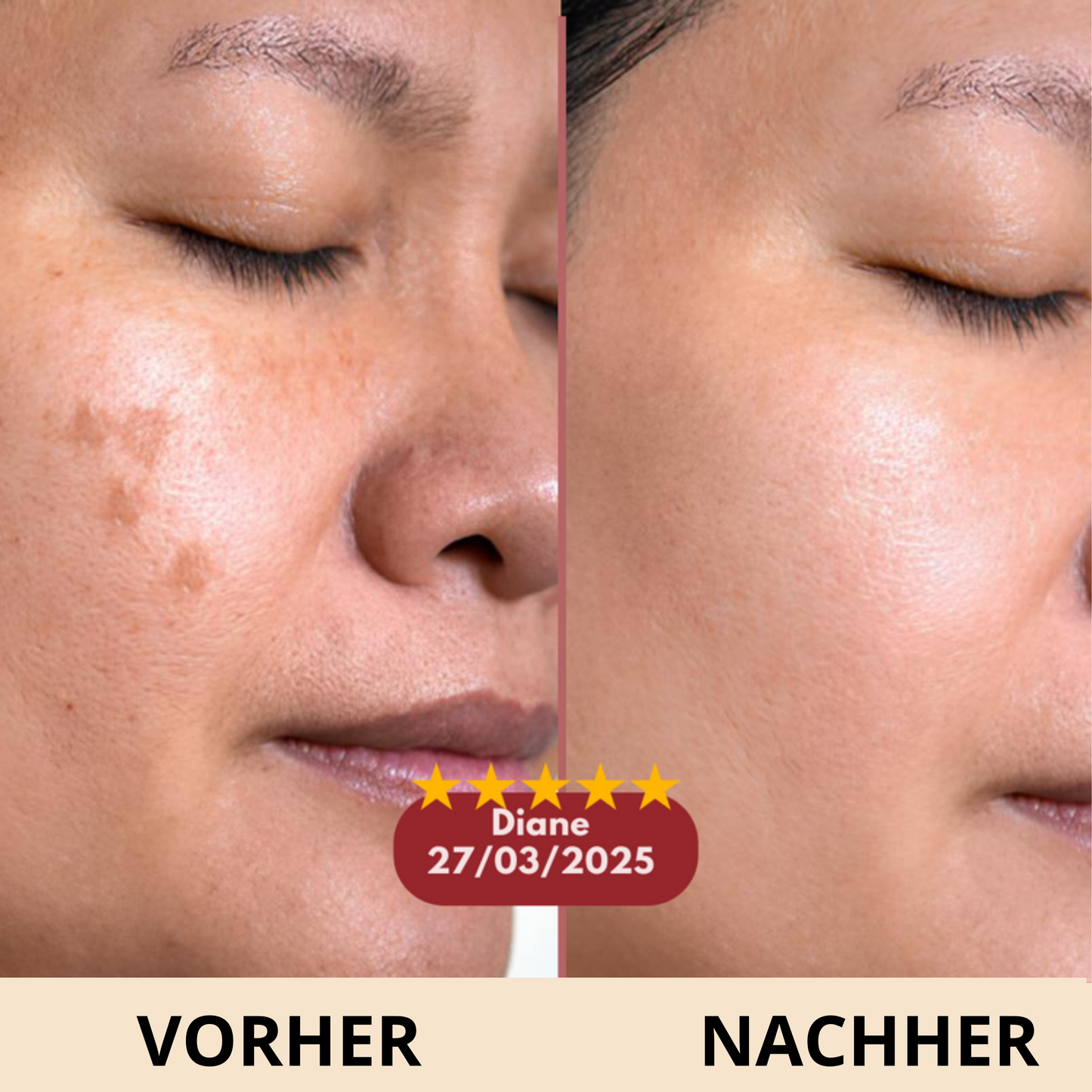 Celyana Calcium-Aufpolsternder Balsam