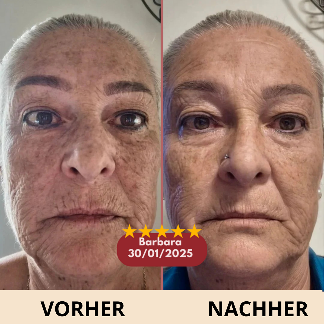 Celyana Calcium-Aufpolsternder Balsam