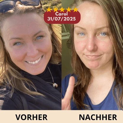 Celyana Calcium-Aufpolsternder Balsam